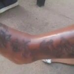 Lady in severe pain as a result of tattoo infection
